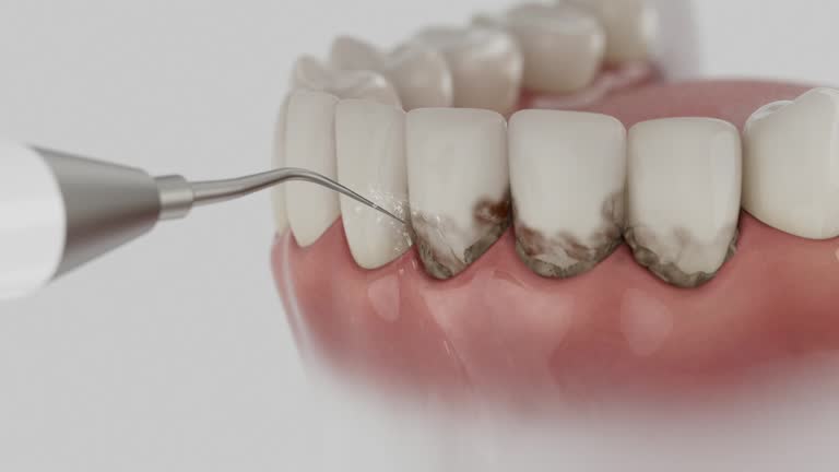 Reliable Dental Implants contractor in Bouse, AZ by Smile Center Dentistry